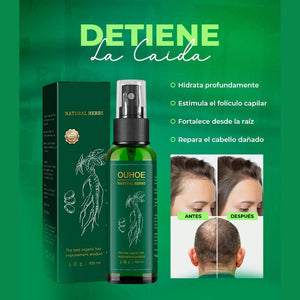 🌟OUHOE🌟 - Crecimiento y fortalecimiento capilar por excelencia